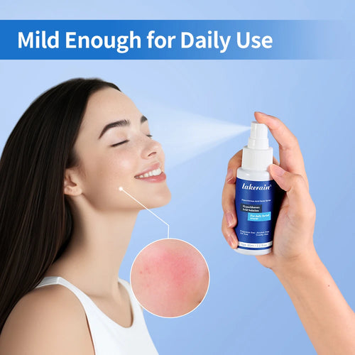 Sheba Hypochlorous Acid Spray - Facial Cleanser for Breakouts, Targets Bacteria for Post-Workout Pimples, Blemishes and Sweat Irritation; 2.2 fl oz Spray, Safe for All Ages: Adults and Teens